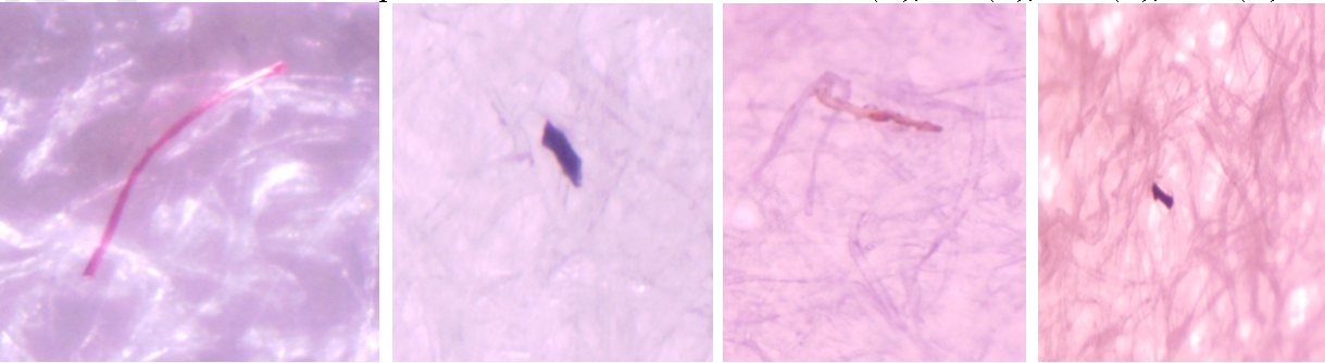 Inhibisi
